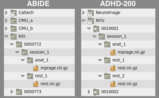 ../_images/abide_adhd_structure.png