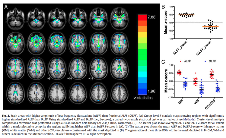 Amplitude of Low Frequency Fluctuations (ALFF) and fractional ALFF (f ...