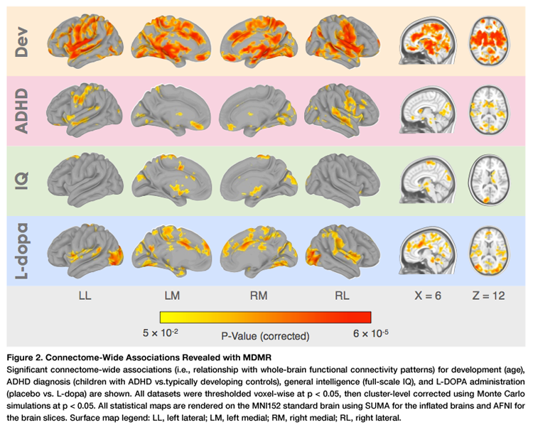 ../_images/cwas_shehzad_brains.png