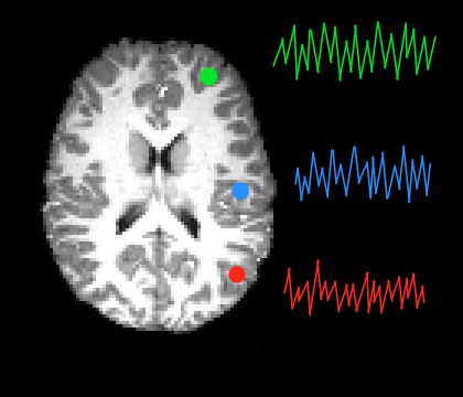 ../_images/roi_timeseries.png